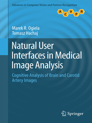 cover image of Natural User Interfaces in Medical Image Analysis